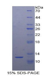 Recombinant Semaphorin 3E (SEMA3E)