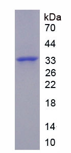 Recombinant Nuclear Factor, Erythroid Derived 2 Like Protein 2 (NFE2L2)