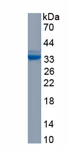 Recombinant NADH Dehydrogenase, Quinone 1 (NQO1)