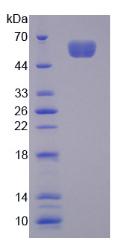 Recombinant NUAK Family SNF1 Like Kinase 1 (NUAK1)