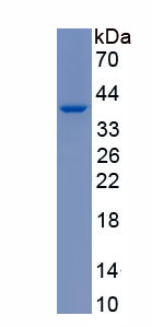 Recombinant Sterile Alpha Motif Domain Containing Protein 2 (SaMD2)