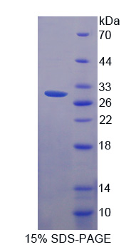 Recombinant SCO Cytochrome Oxidase Deficient Homolog 2 (SCO2)