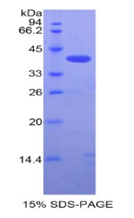 Recombinant Single Ig IL1 Related Receptor (SIGIRR)