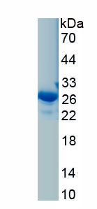 Recombinant Twinfilin 1 (TWF1)