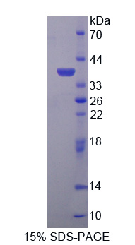 Recombinant HAUS Augmin Like Complex Subunit 7 (HAUS7)