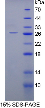 Recombinant HAUS Augmin Like Complex Subunit 7 (HAUS7)