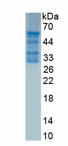 Recombinant Metastasis Associated In Colon Cancer 1 (MACC1)