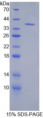 Recombinant Keratin 71 (KRT71)