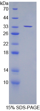 Recombinant Suppressor Of Variegation 4-20 Homolog 2 (SUV420H2)