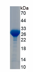 Recombinant Transmembrane Protein 173 (TME<b>M173</b>)