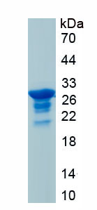 Recombinant RNA Binding Motif Protein 20 (RBM20)