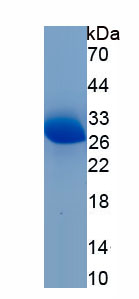 Recombinant Spindle Pole Body Component Protein 24 (SPC24)
