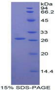 Recombinant T-Cell Immunoreceptor With Ig And ITIM Domains Protein (TIGIT)