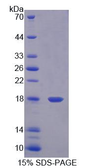 Recombinant Esophageal Cancer Related Gene 4 (ECRG4)