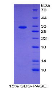 Recombinant Cell Death Inducing DFFA Like Effector C (CIDEC)