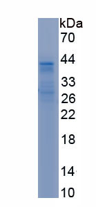 Recombinant Wingless Type MMTV Integration Site Family, Member 5B (WNT5B)