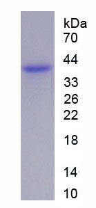 Recombinant Wingless Type MMTV Integration Site Family, Member 5A (WNT5A)