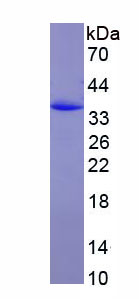 Recombinant T-Box Protein 21 (TBX21)