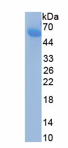Recombinant Proteasome 26S Subunit, Non ATPase 8 (PSMD8)