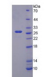 Recombinant Potassium Inwardly Rectifying Channel Subfamily J, Member 10 (KCNJ10)