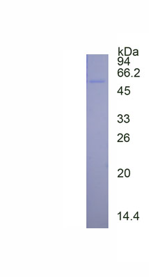 Recombinant Cluster Of Differentiation 8b (CD8b)