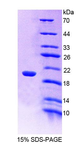 Recombinant Cellular Repressor Of E1A Stimulated Genes 1 (CREG1)