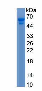 Recombinant Discs, Large Homolog Associated Protein 5 (DLGAP5)