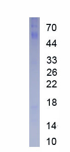 Recombinant Leucine Rich Repeat Containing Protein 15 (LRRC15)