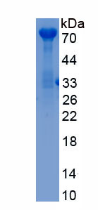 Recombinant Peptidase Inhibitor 16 (PI16)