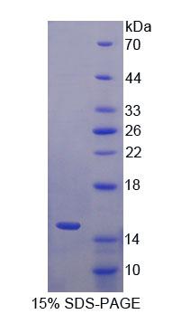 RPQ981Hu01.jpg