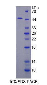 Recombinant Ovarian Cancer Immuno Reactive Antigen Domain Containing Protein 2 (OCIAD2)