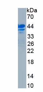 Recombinant Complement Component 4d (C4d)