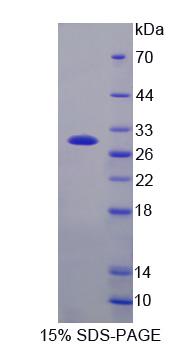 Recombinant Notch2 N-Terminal Like Protein (NOTCH2NL)