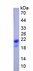 Recombinant Unique Cartilage Matrix Associated Protein (UCMA)