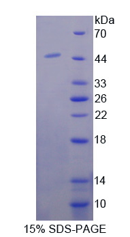 Recombinant Coiled Coil Domain Containing Protein 60 (CCDC60)