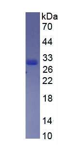 Recombinant Coiled Coil Domain Containing Protein 60 (CCDC60)