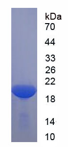 Recombinant Microtubule Associated Protein 1 Light Chain 3 Beta 2 (MAP1LC3b2)