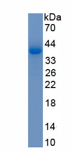 Recombinant Transport And Golgi Organization Protein 2 Homolog (TANGO2)