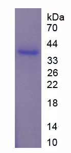 Recombinant ADP Ribosylglutamate hydrolase (AF1521)