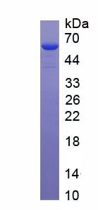 Recombinant Histone Gene Specific Epigenetic Repressor in Late S Phase, Isoform D (Hers)