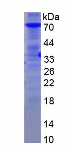 Recombinant PAI-1/tPA Complex (tPA/PAI1)