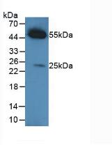 HRP-Linked Rabbit Anti-Caprine IgG Polyclonal Antibody