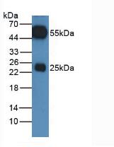 HRP-Linked Rabbit Anti-Equine IgG Polyclonal Antibody