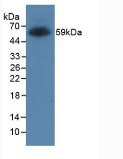 Anti-Glutathione S Transferase (GST) Tag Monoclonal Antibody