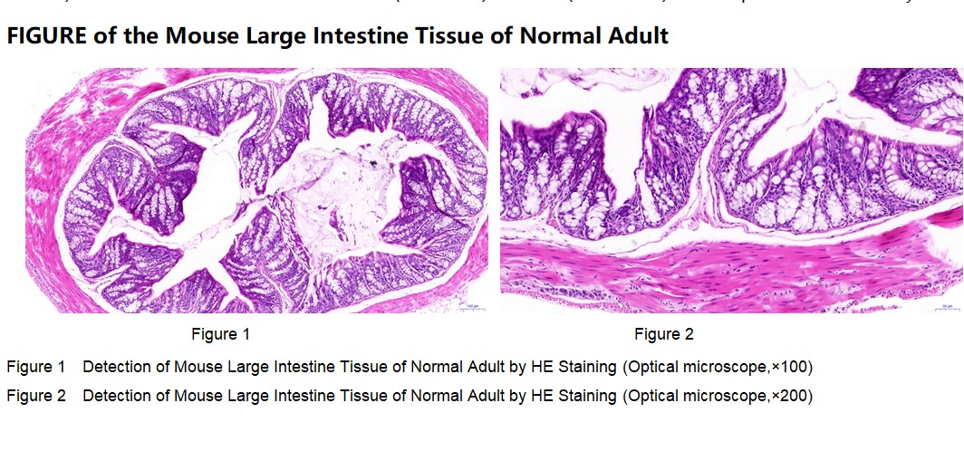 Mouse Large Intestine Tissue of Normal Adult
