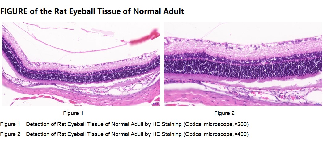Rat Eyeball Tissue of Normal Adult