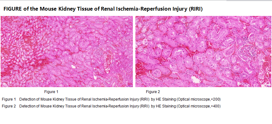 Mouse Kidney Tissue of Renal Ischemia-Reperfusion Injury (RIRI)