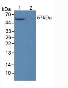 Anti-Phosphorylated Protein Kinase B Alpha (PKBa) Polyclonal Antibody