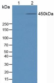 Anti-Phosphorylated Tumor Protein p53 Binding Protein 1 (TP53BP1) Polyclonal Antibody