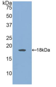 Active Angiopoietin 2 (ANGPT2)